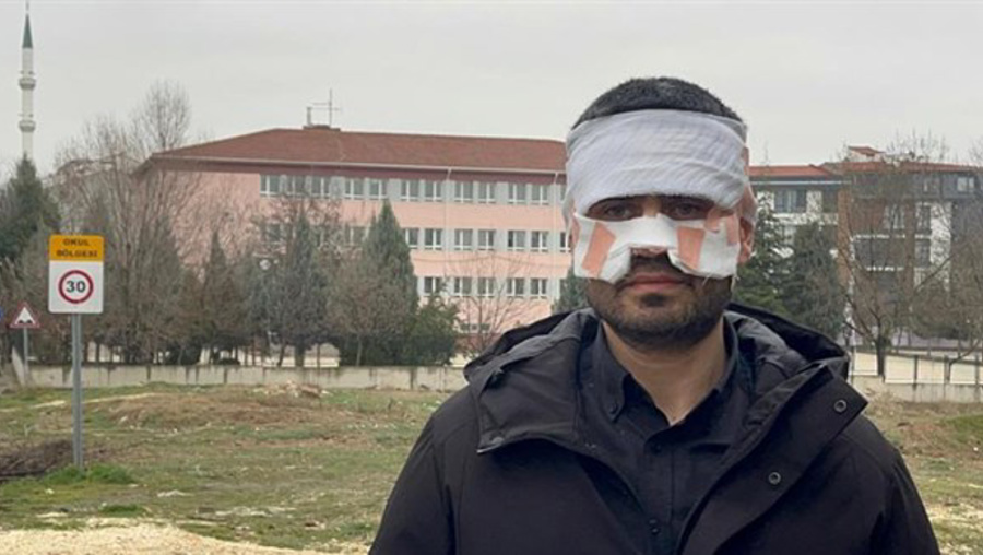 Meslektaşının yüzüne sıcak çay fırlatan öğretmene adli kontrol